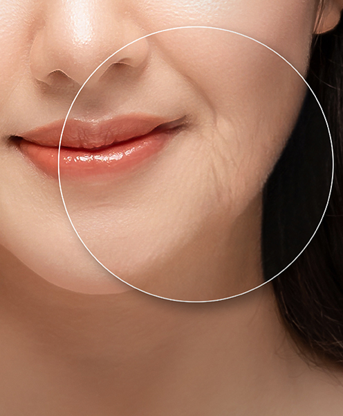 What Causes Ageing Skin?