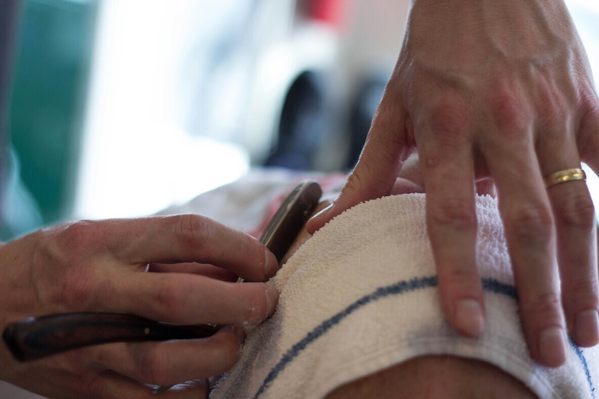 advantages of the HydraFacial treatment