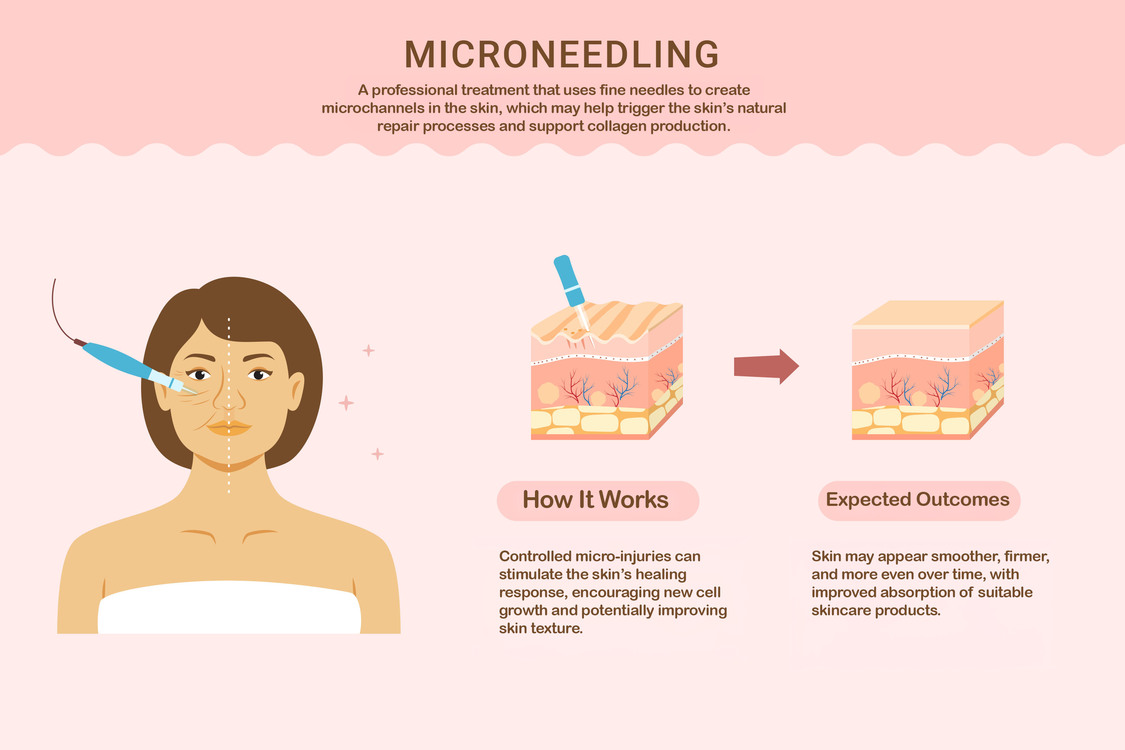 Combine Microneedling and Hydration-Based Treatments