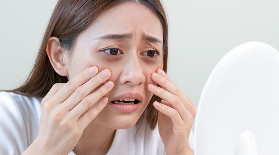 dark eye circles causes